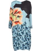 Etro Short Dress - Lyst