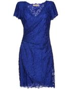 Emilio Pucci Short Dress - Lyst