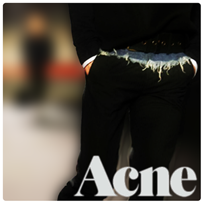 LMJukez's Best Picks: Acne
