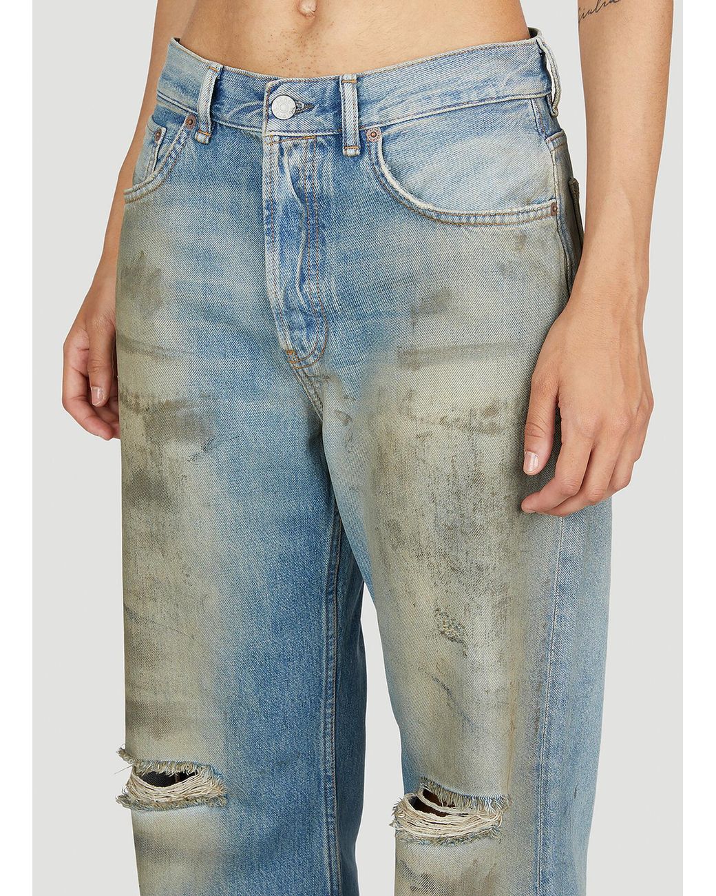 Acne Blue Worn