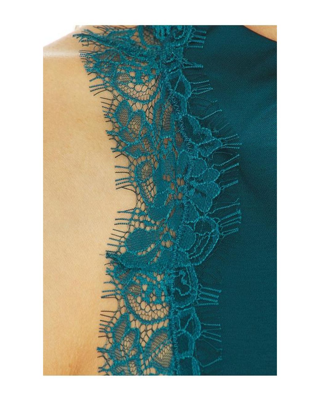 A.L.C. Blue Miriam Dress