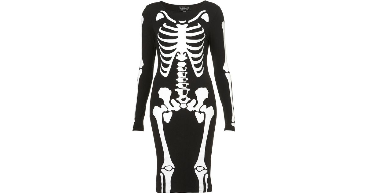 topshop skeleton dress
