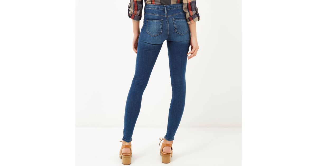 black molly reform jeggings
