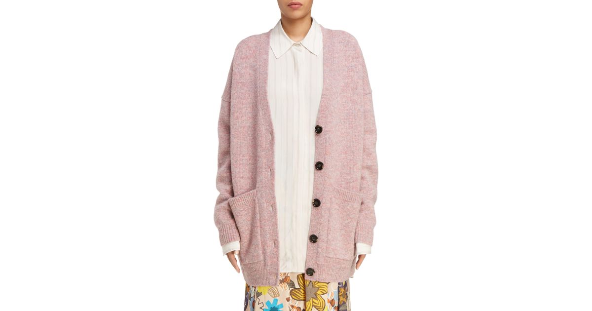oversized button cardigan
