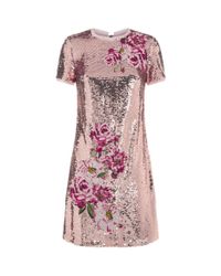 my dress your dress