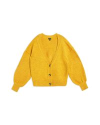 topshop yellow cardigan