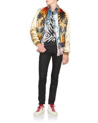 ysl palm jacket