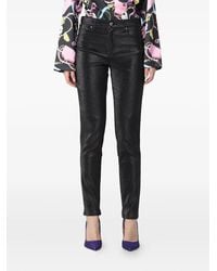 Chiara Ferragni - Buttoned Trousers - Lyst