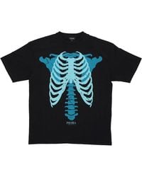 PHOBIA ARCHIVE - Tops ,Zwart ,Katoen Skeleton Print Tee - Lyst