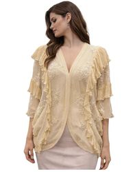 Aniye By - Cardigan - Lyst