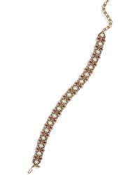 Kenneth Jay Lane - Faux Ruby & Faux Pearl Choker Statement Necklace - Lyst