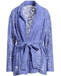 Rebel Queen - Jacket Cotton, Viscose, Polyamide, Polyester - Lyst