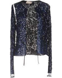 Emilio Pucci Cardigan - Blue
