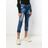 DSquared² Blue Bleached Effect Cropped Jeans