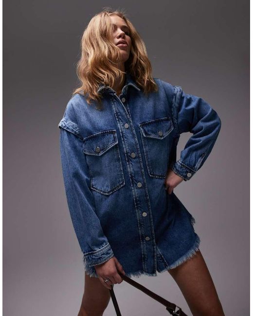 AllSaints Blue Snap Dress