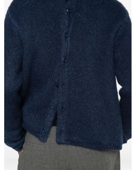 Loewe Vest Met Knopen in het Blue