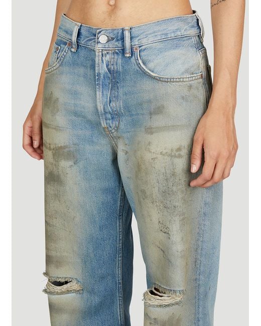Acne Blue Worn