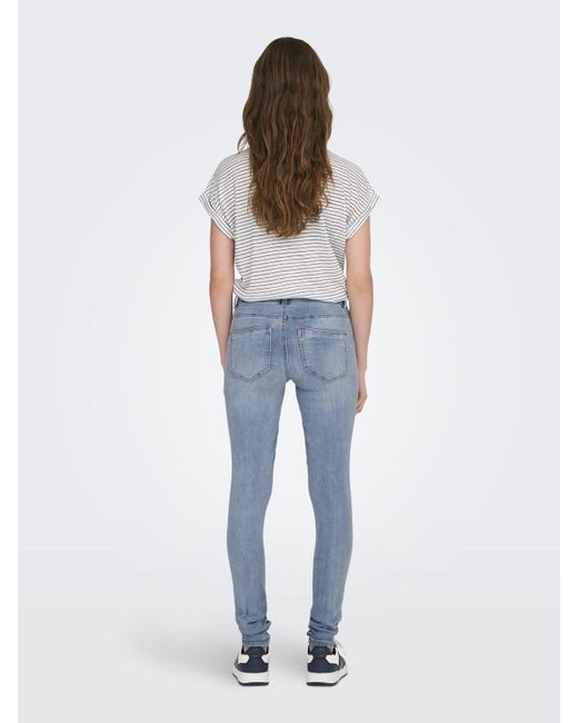 ONLY Blue Skinny-fit-Jeans ONLWAUW MW DESTROY BLEACH DNM GUA mit Destroyed Effekt
