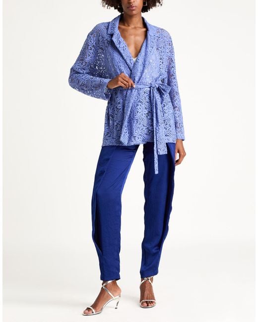 Rebel Queen Blue Jacket Cotton, Viscose, Polyamide, Polyester