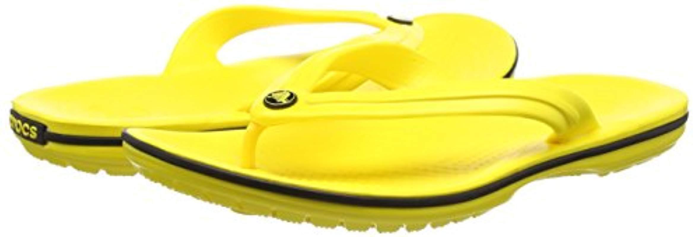banana jibbitz