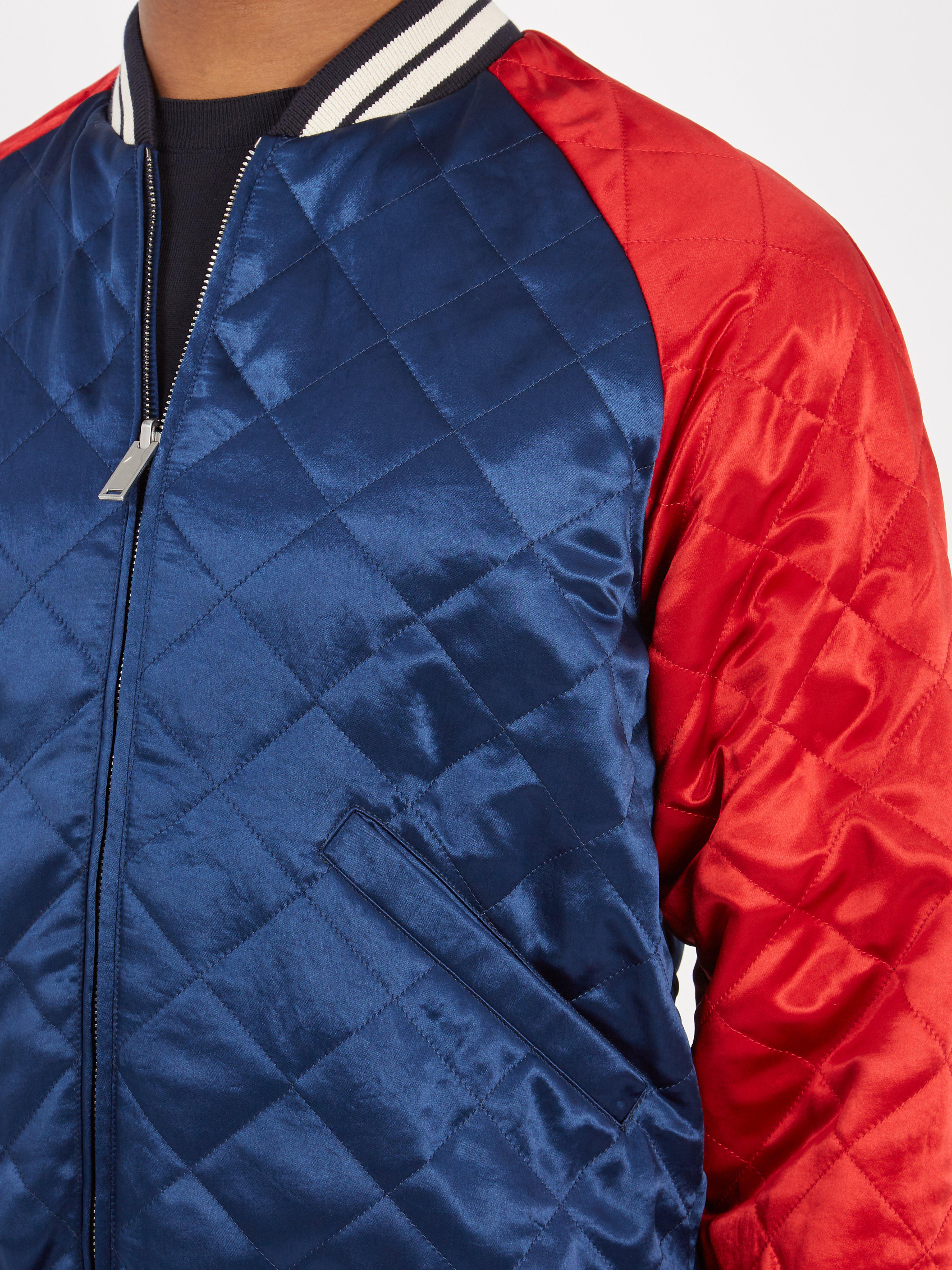 gucci stripe reversible acetate bomber