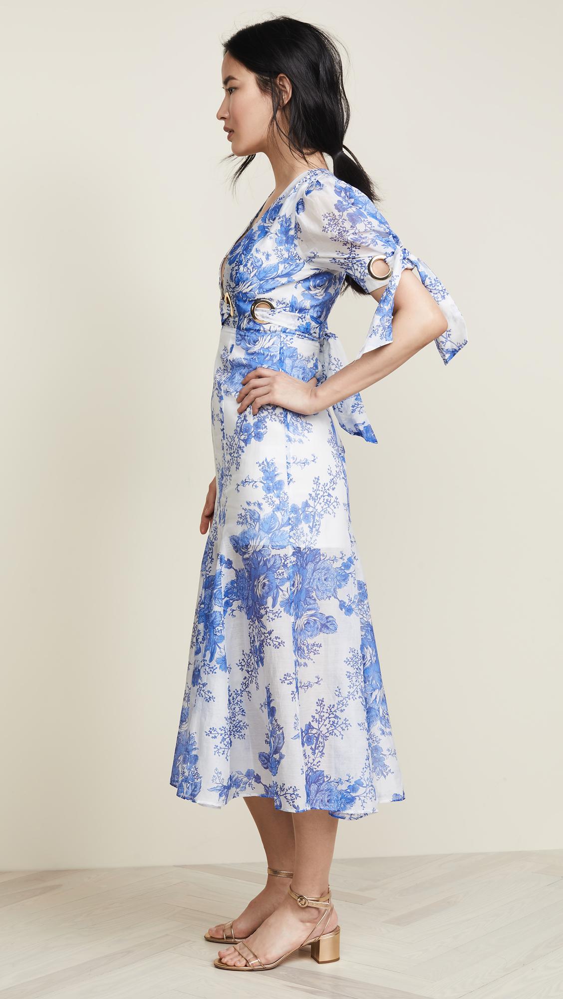 only everything midi dress