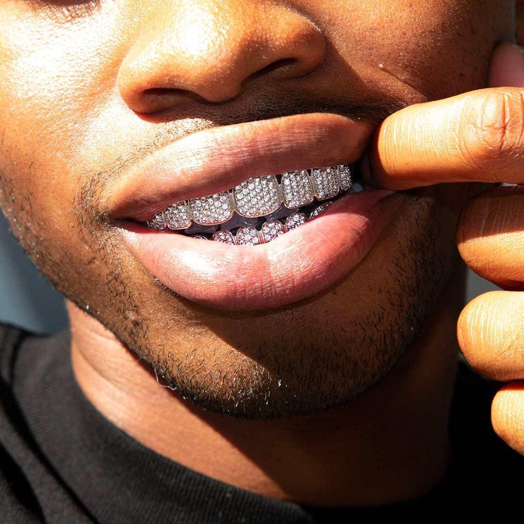 The GLD Shop Grillz Custom Mold Kit for Men Lyst